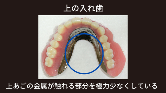 チタン金属床義歯・ノンクラスプデンチャーの部分入れ歯・総入れ歯の